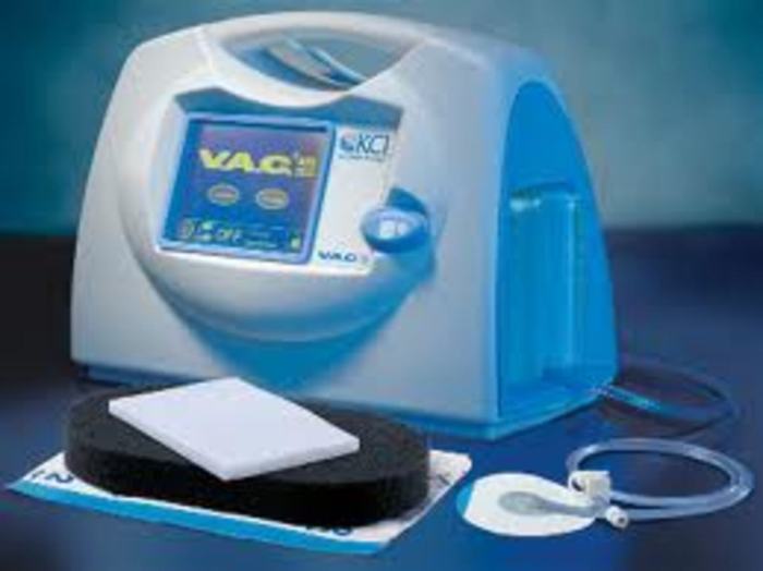 Wound pressure negative therapy vac nephew smith npwt dressing system go procedure step below using wounds